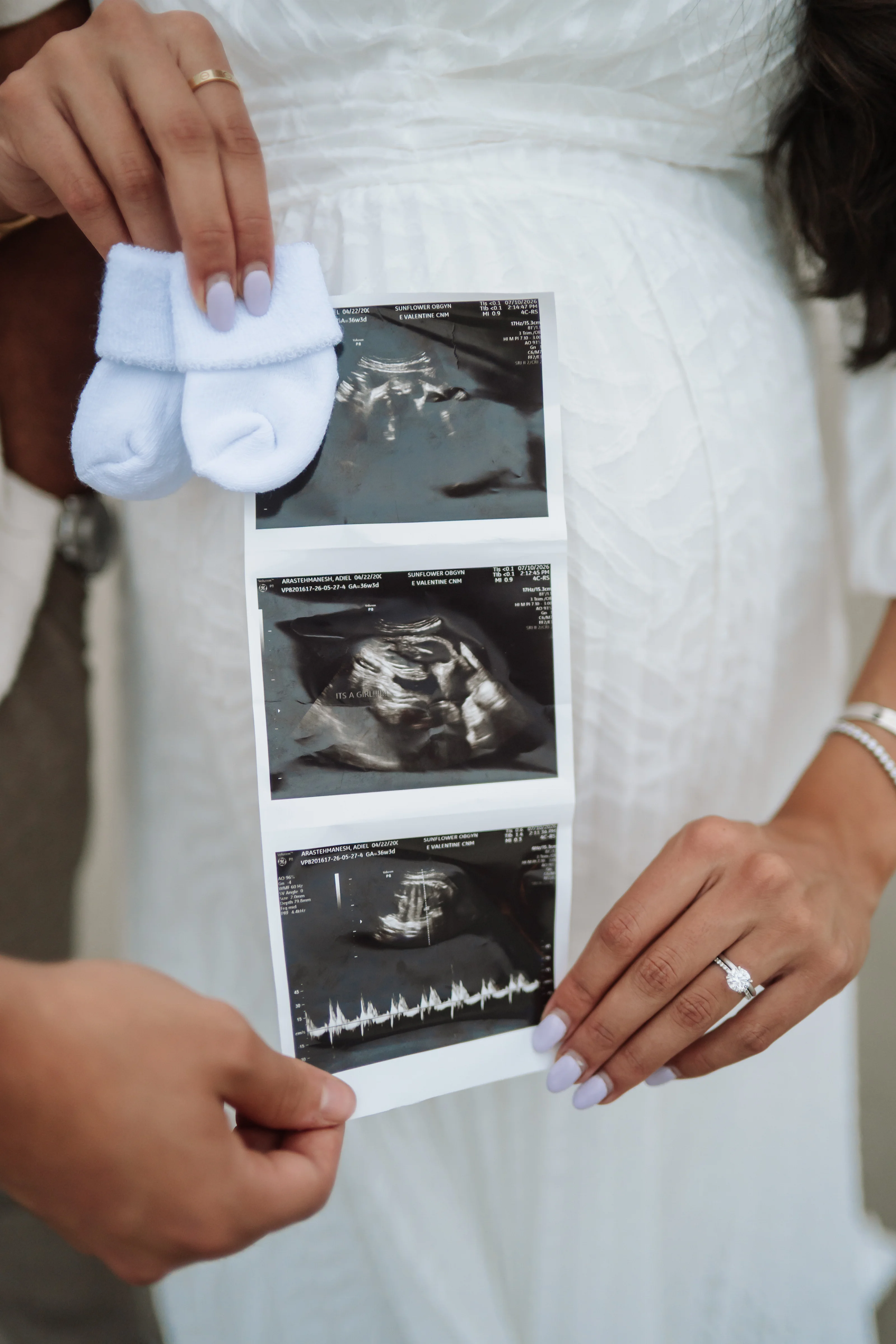 Close-up of a couple’s hands holding three ultrasound images and soft blue baby socks against a light fabric backdrop.